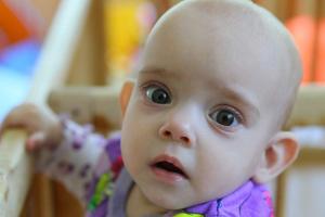 The baby has swelling under the eyes: causes and treatment